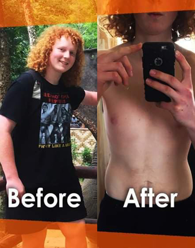 Kieran - Before and After